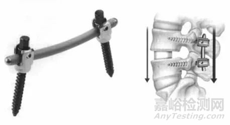 医用3D打印的新工艺与新材料是骨科植入制造的技术支撑