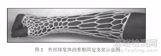 医用3D打印的新工艺与新材料是骨科植入制造的技术支撑