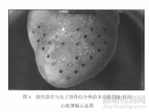 医用3D打印的新工艺与新材料是骨科植入制造的技术支撑