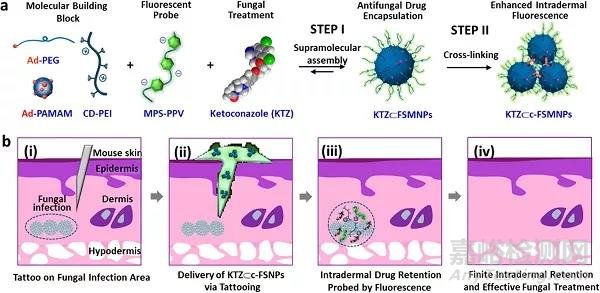 皮下注射具有荧光的交联超分子纳米颗粒控释抗真菌药物用于治疗甲真菌病