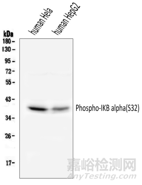 蛋白质磷酸化的检测方法
