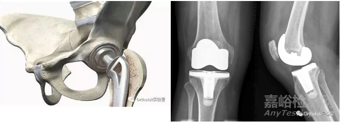 骨科植入物的微观性能评价与失效分析
