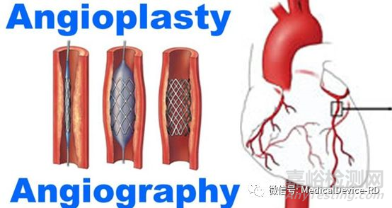 多层医用导管的生产、研发技术与产品知识