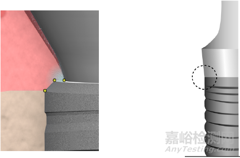 牙种植体基台产品注册技术审查指导原则 ( 征求意见稿）