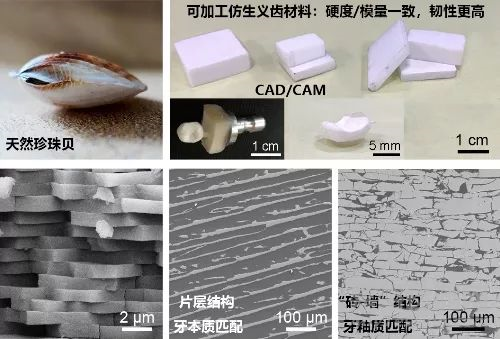 中科院研发出新型氧化锆-树脂仿生复合义齿材料