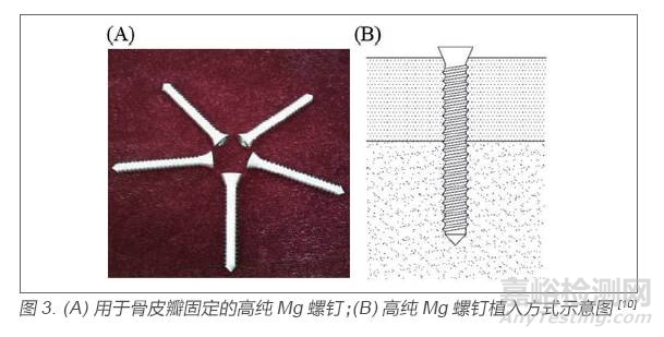 医用金属材料研发与应用进展