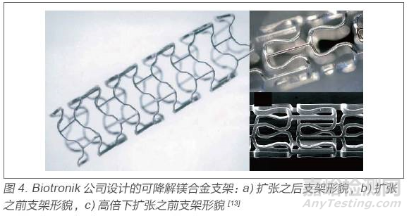 医用金属材料研发与应用进展