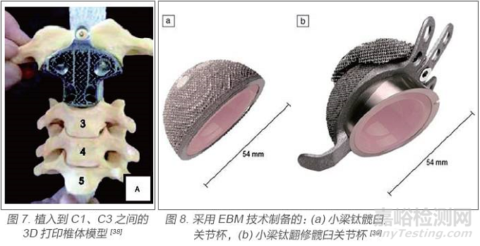 医用金属材料研发与应用进展