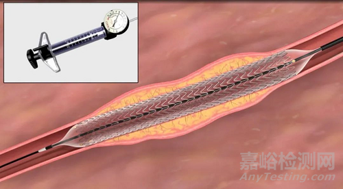 我国首个外周药物洗脱支架获批上市