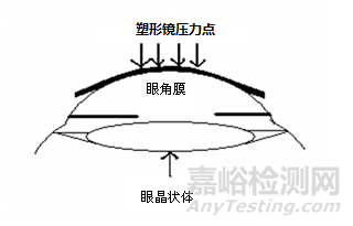 角膜塑形用硬性透气接触镜说明书编写指导原则（2020年修订版）全文发布