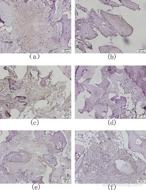 基于组织病理学及影像数据分析的人工骨植入实验评价研究