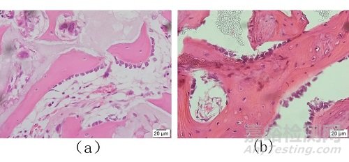 基于组织病理学及影像数据分析的人工骨植入实验评价研究