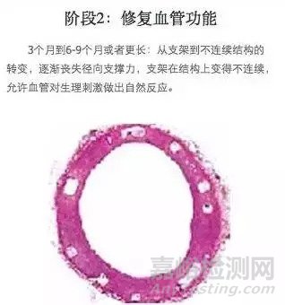 生物可降解支架的介绍及原理