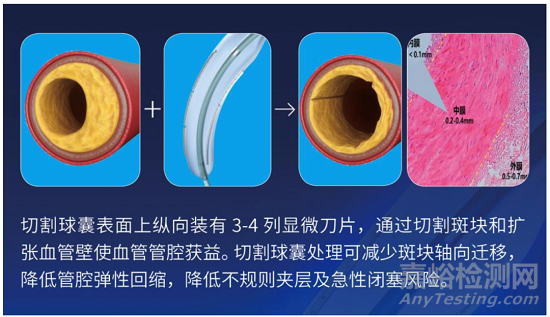 乐普医疗“切割球囊系统”获NMPA批准上市