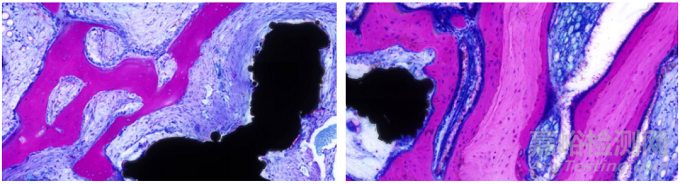 含植入物不脱钙骨组织病理切片技术在骨组织形态学研究中的应用