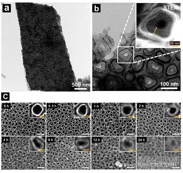 钛纳米多孔结构表面垂直向介孔二氧化硅薄膜的制备及生物学评价
