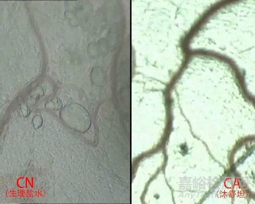 从不溶性微粒角度解读注射剂原研药与仿制药的差异