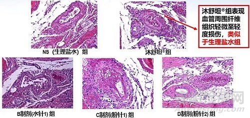 从不溶性微粒角度解读注射剂原研药与仿制药的差异