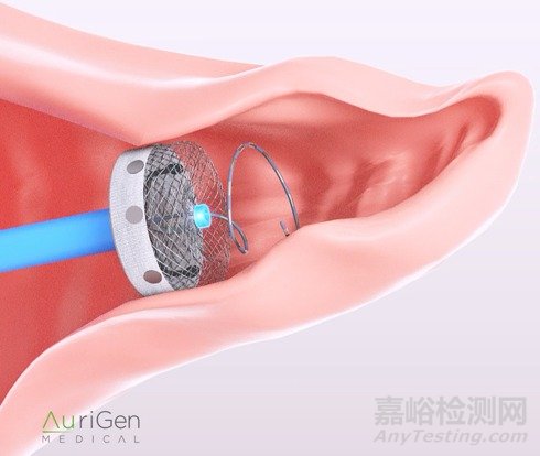 AuriGen LAA：拥有消融功能的左心耳封堵器