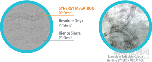 波士顿科学Synergy Megatron药物洗脱支架获FDA批准上市