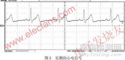 心电采集系统中模拟电路的设计方案