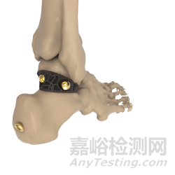 增材制造技术在骨科植入物领域的应用