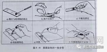 几种常用的微生物染色方法