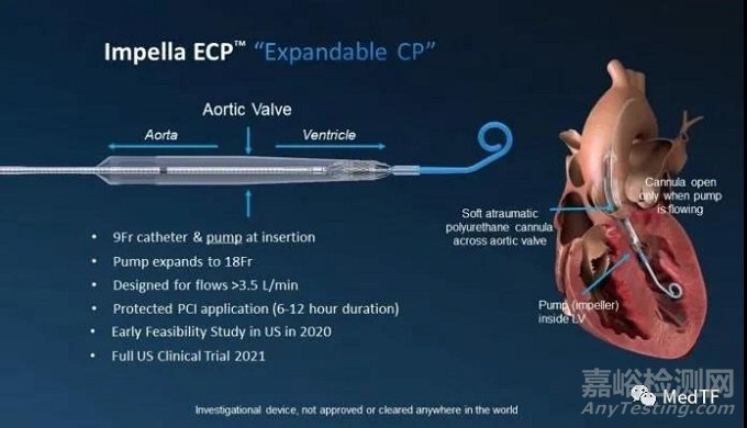 Impella ECP：最小心脏泵获得FDA授予“突破性设备”称号