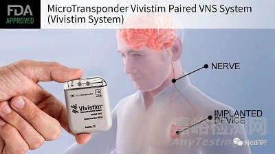 Vivistim：FDA 批准首个中风康复器械---迷走神经刺激
