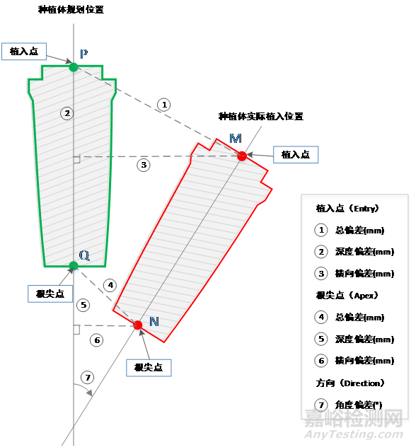 口腔种植手术导航定位系统同品种临床评价注册审查指导原则征求意见