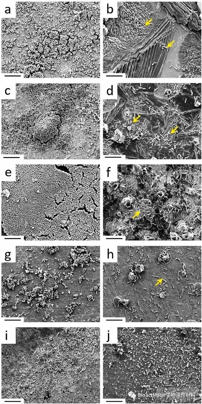 用于支架植入的Zn-Mg和Zn-Cu合金：从纳米力学表征到体外降解和生物相容性