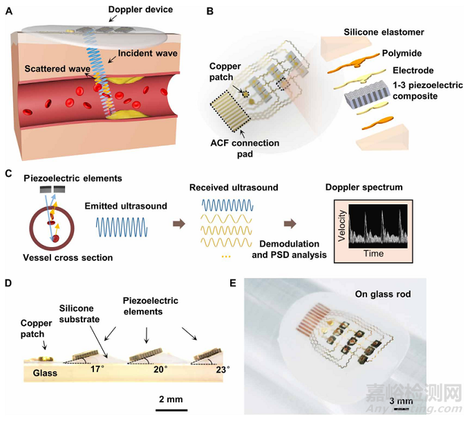 清华大学冯雪教授《Sci.Adv.》：可以贴在皮肤上的柔性多普勒超声仪