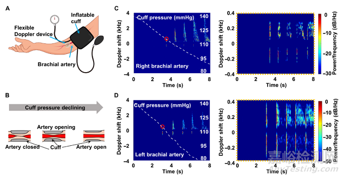 清华大学冯雪教授《Sci.Adv.》：可以贴在皮肤上的柔性多普勒超声仪