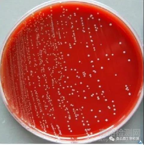 微生物检验方法标准解读之金黄色葡萄球菌