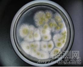 常见霉菌形态描述及典型菌落图片汇总