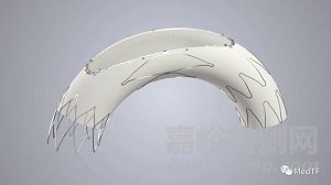 SYNAXIS：主动脉弓过滤器 开启全新中风预防理念