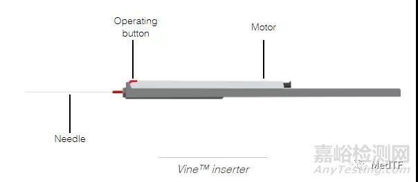 Vine：螺旋型过滤器 预防中风