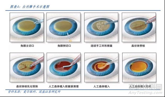 人工晶状体分类及代表企业盘点