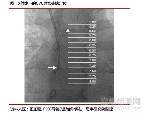 手术机器人空间定位系统技术原理