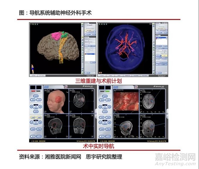 手术机器人导航系统技术的应用实例与发展趋势