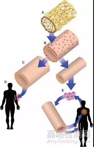 人工血管常用材料及制作技术