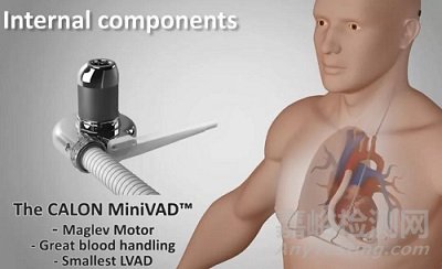 FiVAD：无线心室辅助装置 完成临床前研究