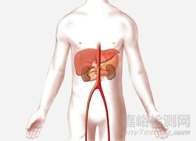 iRF Denervation：开启去交感神经治疗糖尿病研究