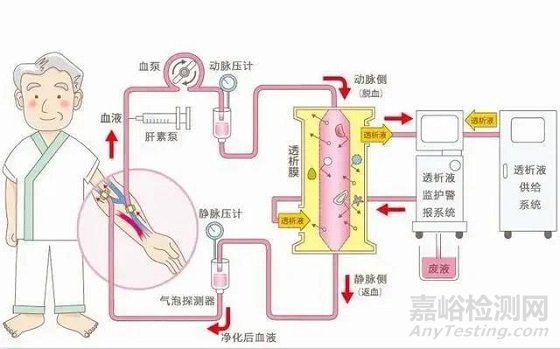 中美人工血管新产品与新技术