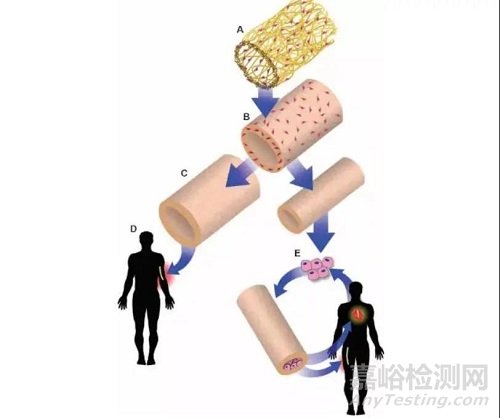 中美人工血管新产品与新技术