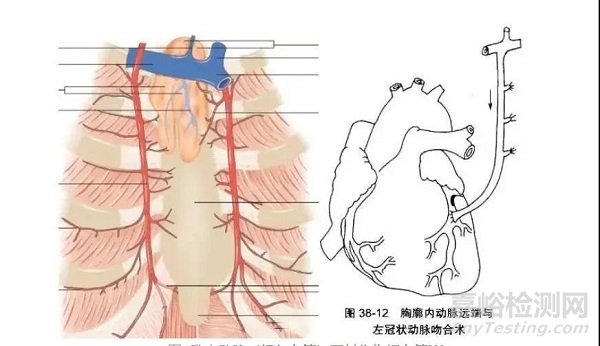 中美人工血管新产品与新技术