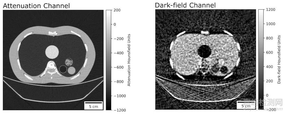 暗场CT可用于临床成像