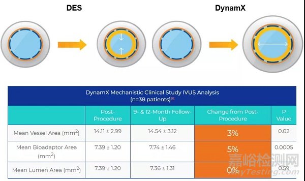 Dynamx ：一种术后可以松脱的冠脉支架