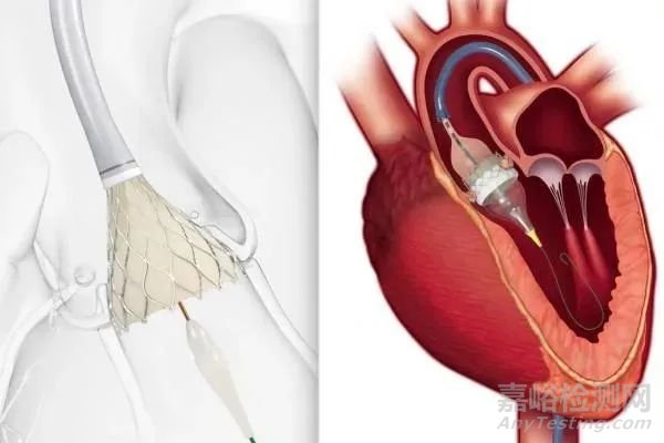 心脏瓣膜介入医疗器械专利分析报告