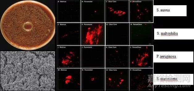 全球首例角膜接触镜高效除蛋白设备已通过FDA 510K认证，有望将角膜接触镜护理系统带到有源时代